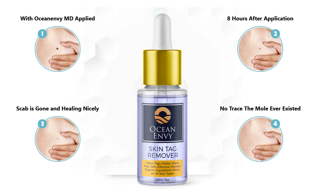 Mole & Skin Tag Corrector Serum